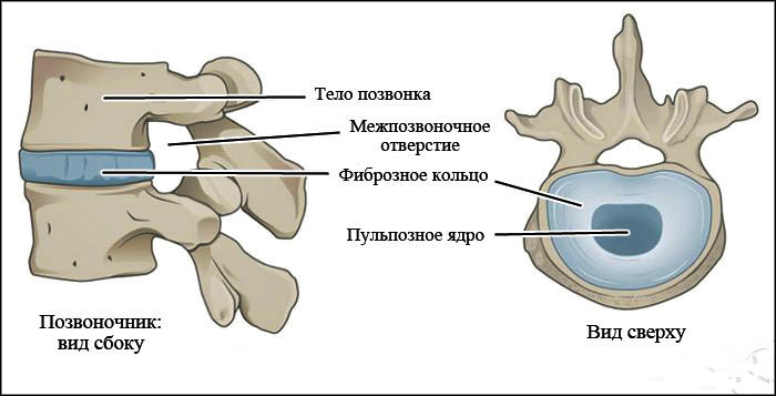 Восстанавливается ли межпозвоночный диск после операции